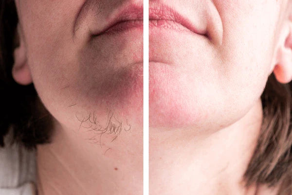 Crema depilatoria facial - Fórmula suave, no irritante y resultados visibles en solo minutos - ¡Gran promo segunda unidad GRATIS!!